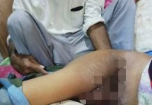 Saat Blusukan Tim Pas’AppiNA Temukan Warga Tidak Mampu Penderita Tumor Ganas, Langsung di Evakuasi ke Rs. Wahidin