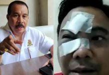 Penyidik Ditreskrimum Polda Metro Jaya Tahan Azis Samual, Kasus Pemukulan Ketum KNPI Kiri Azis Samual dan Kanan Ketum KNPI Haris Pertama