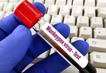 Cacar Monyet Merebak di Israel, Amerika dan Eropa, WHO Pastikan Ketersedian Vaksin FOTO: Monkeypox Virus - Test/Net