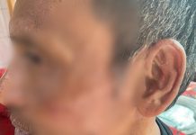 Hendak Melerai, Petugas Pajak Justru Dapat Bogem dari Oknum Anggota DPRD Bulukumba FOTO: Ancong (54) Petugas Pajak Bumi dan Bangunan (PBB) alami luka memar usai dianiaya.