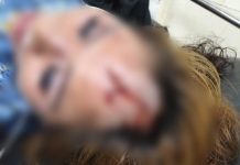 Belum Diketahui Indentitasnya Perempuan ini Korban Begal di Kota Dunia Makassar FOTO: Korban Begal di Jalan Veteran Kota Makassar. Jumat malam (12/5) (istimewa)