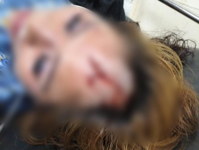 FOTO: Korban Begal di Jalan Veteran Kota Makassar. Jumat malam (12/5) (istimewa)