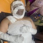 Merokok di Kamar Mandi, Boom ! Seorang Sopir di Wajo Alami Luka Parah FOTO: Syahda Yusuf (25), Penghuni kosan yang jadi korban ledakan gas di Kabupaten Wajo, Sulsel, Sabtu (8/7/2023). Foto: Dok. Istimewa