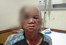 Supir Mobil Box Indomaret Hantam Betor Berpenumpang Seorang Nenek Masuk RSUD Adam Malik FOTO: Nenek korban tabrakan Mobil Box Indomaret saat berada di RSUD Adam Malik Medan