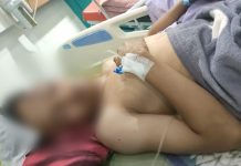 Kader HPMB Korban Kekerasan, Polres Bantaeng Dinilai Lamban Tangkap Pelaku Lainnya, Ancam Gelar Demo FOTO: Dzulkifli kader Himpunan Pelajar dan Mahasiswa Bantaeng (HPMB) saat berbaring di rumah sakit Wahidin Sudirohusodo di Makassar beberapa waktu lalu.