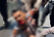 Aksi Brutal Mahasiswa Asal Papua, Aparat Jadi Korban, Fasilitas Umum Dirusak, Eks Batalion 120: Jangan Buat Kami Marah FOTO: Satu Anggota Polri dari Unit Shabara Polrestabes Makassar jadi korban kekerasan aksi brutal mahasiswa Papua. (Istimewa)