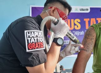 Setahun Kegiatan Hapus Tato Gratis Terhenti akibat Kerusakan Mesin Laser FOTO: Kimi Yayasan Mahtan kembali akan laksanakan Kegiatan Hapus Tatto gratis (Treatmen) lanjutab bagi Penerima Manfaat yang akan di laksanakan Minggu 21/12/2025 di Posko Mahtan Jalan Hertasning V No 16 Kota Makassar.