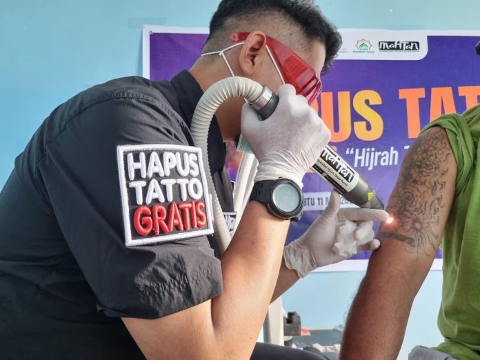 FOTO: Kimi Yayasan Mahtan kembali akan laksanakan Kegiatan Hapus Tatto gratis (Treatmen) lanjutab bagi Penerima Manfaat yang akan di laksanakan Minggu 21/12/2025 di Posko Mahtan Jalan Hertasning V No 16 Kota Makassar. 