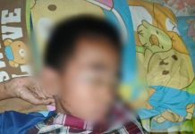 Sakit Misterius Siswa SD Campaga Butuh Perhatian Pemkab Bulukumba FOTO: Herul murid Kelas IV, SD 54 Campaga Desa Tamaona, Kecamatan Kindang, Kabupaten Bulukumba, Sulawesi Selatan. (Dok via Facebook)