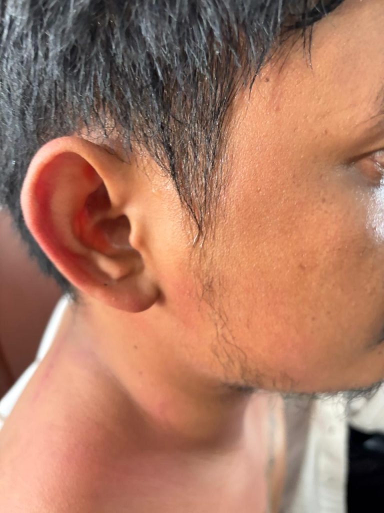Ket Foto: Peserta RDP dari Pembawa Aspirasi saat RDP yang dianiaya oleh oknum preman (**)