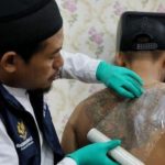 Hapus Tatto Gratis kembali akan hadir di Sulawesi Barat FOTO: Seorang profesional sedang membersihkan tatto. (Dok via Google)