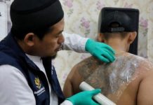 Hapus Tatto Gratis kembali akan hadir di Sulawesi Barat FOTO: Seorang profesional sedang membersihkan tatto. (Dok via Google)