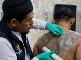 Hapus Tatto Gratis kembali akan hadir di Sulawesi Barat FOTO: Seorang profesional sedang membersihkan tatto. (Dok via Google)