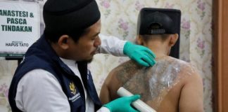 Hapus Tatto Gratis kembali akan hadir di Sulawesi Barat FOTO: Seorang profesional sedang membersihkan tatto. (Dok via Google)