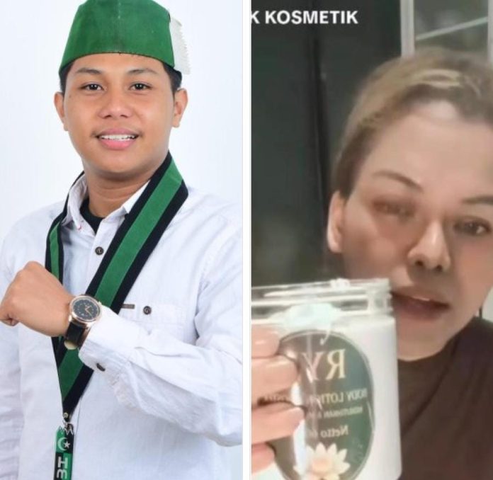 Ket Foto: Gabungan Gambar Direktur LKBHMI HMI Cabang Makassar, Alif Fajar, S.H., & Produk Skincare yang di Sorot (Edt)* Ket Foto: Gabungan Gambar Direktur LKBHMI HMI Cabang Makassar, Alif Fajar, S.H., & Produk Skincare yang di Sorot (Edt)*